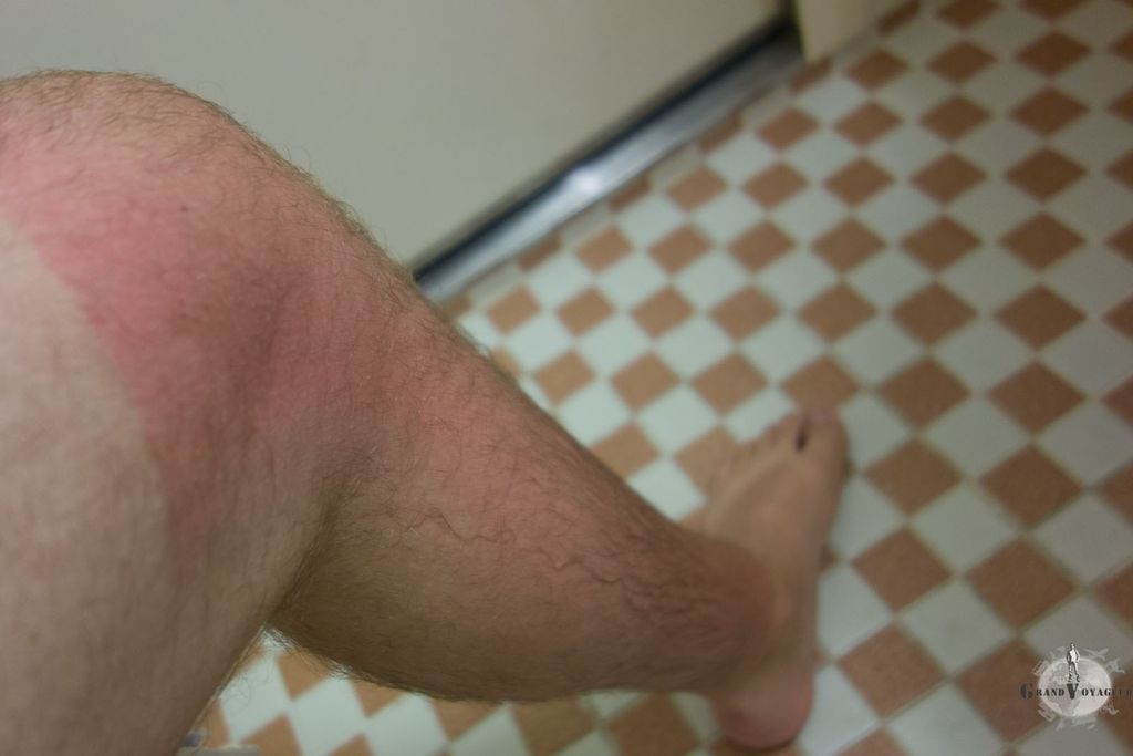 Comment dire. Aïe ?